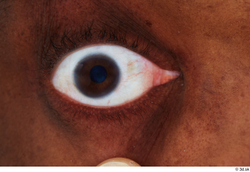 Eye Man Black Eye Textures